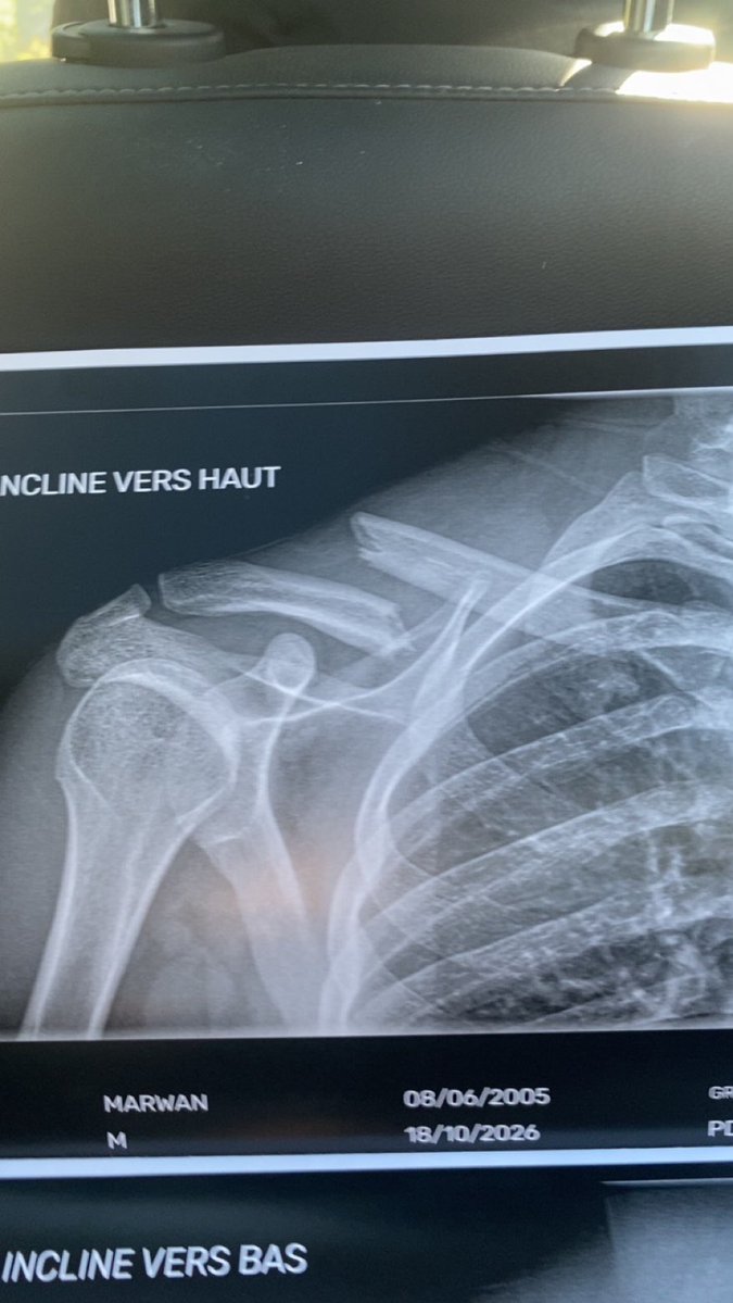inessmgn_'s tweet photo. la bac a traumatisé physiquement et mentalement un ami à moi, je vous jure je suis trop énervée enft j’ai plus les mots, lisez #BAVURE https://t.co/ItEccCH7fL