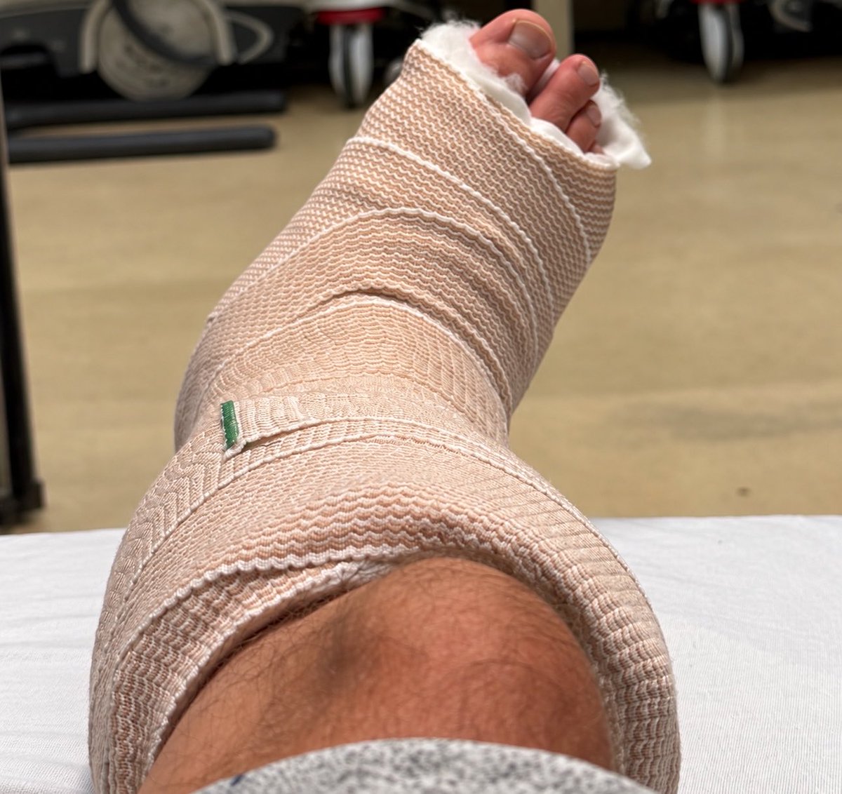 BDStan's tweet photo. Unfortunately, joining the preseason injury announcements with one of my own: a shattered right ankle.

It’ll be a rough few weeks/months, but surgery Wednesday, then a relentless focus on recovery. https://t.co/kkxu2tfXoV