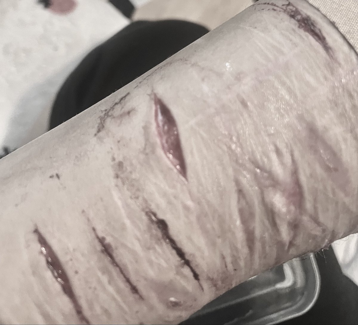 brillianttrees_'s tweet photo. some old chatgpt ai enhanced SFX i forgot to post in honour of halloween!! 
————————
FAKE!! realistic makeup only, not real..pls
-
-
-
#shrtwt 988twt sfxmakeup https://t.co/YWU2u3ix64