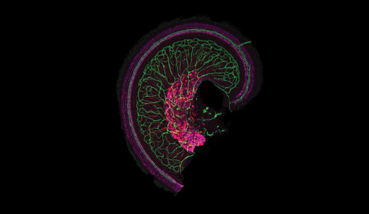 SciNatureNews's tweet photo. BREAKTHROUGH🚨: An experimental gene therapy ear injection has cured deafness for 10 out of 10 patients in clinical trial. https://t.co/TdnaJnnzZz