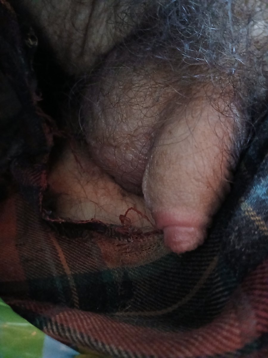 smallpenisa5's tweet photo. My pp #explicit #sph #smallpenishumiliation #tiny #penis #cock #cute #hot #humiliating #embarrassing #mortifying #embarrassed #humiliated #mortified https://t.co/Qhvn7B3pvC
