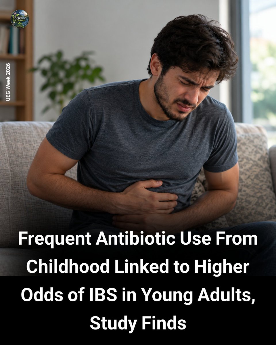 ScienceIsNew's tweet photo. Antibiotics have saved millions of lives by turning dangerous bacterial infections into easily treatable illnesses, yet scientists are discovering that repeated exposure during our growing years can leave a lasting mark on our digestive health. New research presented at United European Gastroenterology Week 2026 in Barcelona reveals that taking antibiotics during late childhood and adolescence is closely linked to a higher risk of developing irritable bowel syndrome in young adulthood.

Researchers at the University of Gothenburg and Sahlgrenska University Hospital in Sweden tracked the health and prescription records of nearly three thousand individuals from age nine to twenty-four. By their mid-twenties, ten percent of the participants had developed irritable bowel syndrome, a common chronic condition that causes ongoing abdominal pain, cramping, bloating, and irregular bowel habits.

The team found that young people who had taken at least one course of antibiotics faced a fifty percent higher likelihood of developing the disorder compared to those who had never used these medications. The risk climbed steadily with every additional prescription a person received, and three or more courses of certain broad-spectrum medications increased the odds by up to six times.

The likely reason behind this connection lies deep inside the gut, where trillions of friendly bacteria help digest food, support the immune system, and communicate directly with the brain. Because antibiotics cannot tell the difference between harmful bacteria causing an infection and the helpful microbes protecting our stomach, repeated treatments during youth can wipe out beneficial species and leave the digestive tract permanently sensitive.

While antibiotics remain vital and life-saving medicines when treating real bacterial infections, this study serves as an important reminder to only use them when truly prescribed and necessary, rather than for everyday viral colds or flu.

Source: Sjölund, J. et al. Antibiotic use from childhood and risk of adult irritable bowel syndrome: findings from a prospective birth cohort. Presented at UEG Week 2026; 19 October 2026; Barcelona, Spain.