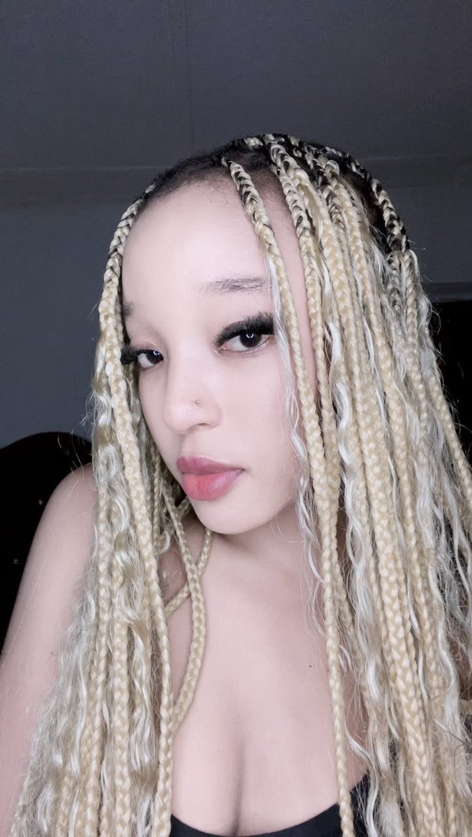 __Poo_kie's tweet photo. Ever seen an albino with black hair?! https://t.co/RFAxVmbCAN