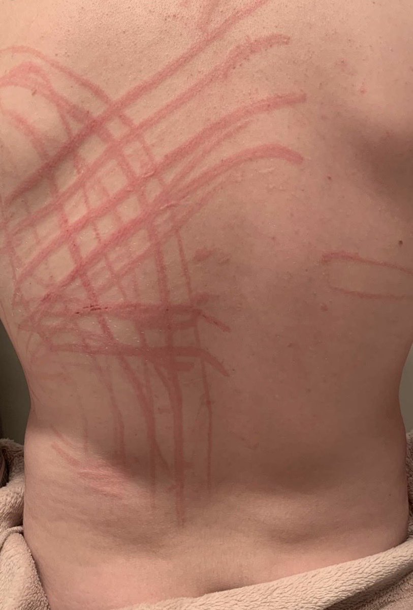 Babywood99's tweet photo. If you treat me how I deserve, your back might also end up looking like the last picture 😇😩🤤 #moothunt〃・ #nsfwtwt #fupa #bbwlove https://t.co/npG02N4jF4