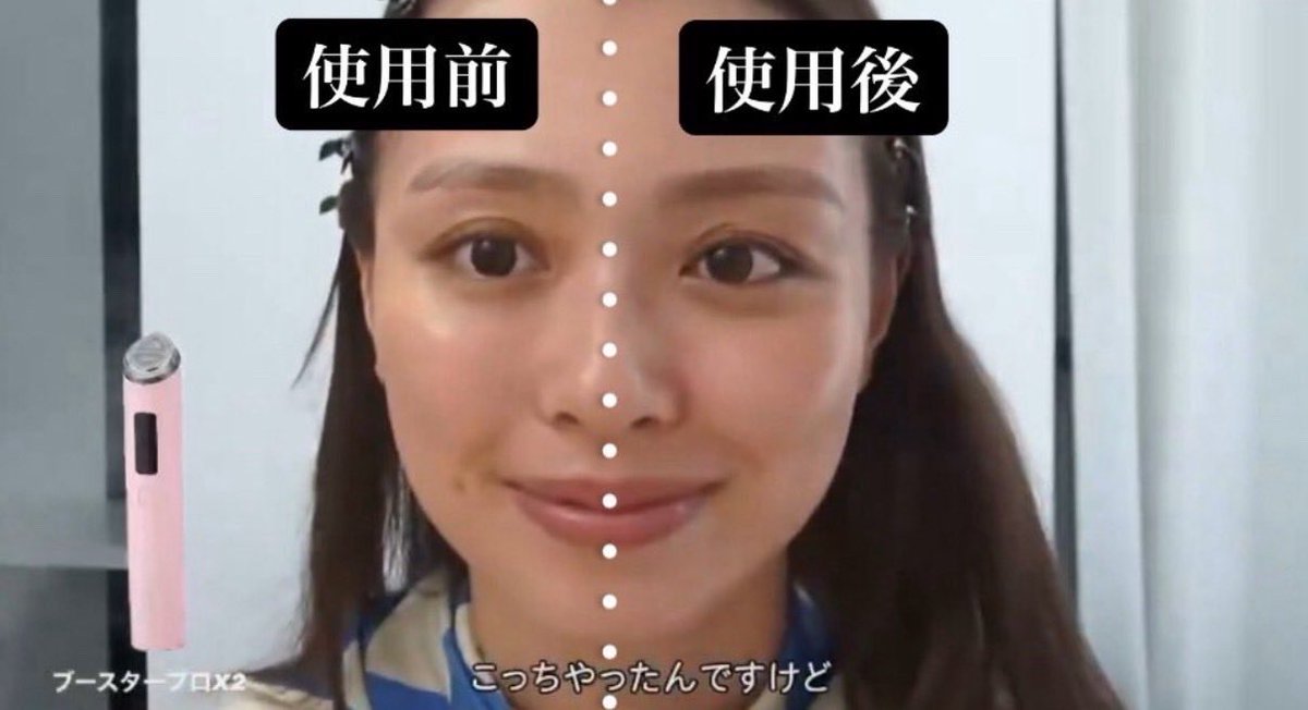 tyuro1224's tweet photo. だーりおちゃんも言ってるけどたった数分でこの変化ヤバくない？
もう整形いらんやろ https://t.co/UzPusvLDvH