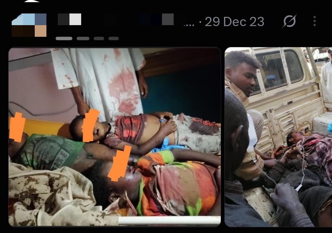 Sudan_Eyes's tweet photo. بتاريخ ٢٩ ديسمبر ٢٠٢٣م ، أوقع الطيران الحربي لمليشيا البرهان الإرهابية أكثر من 100 من المدنيين بين قتيل وجريح معظمهم من الأطفال والنساء وكبار السن في مدينة نيالا بجنوب دارفور.
#السودان #جرائم_الجيش_السوداني https://t.co/0PkwkrTpqI
