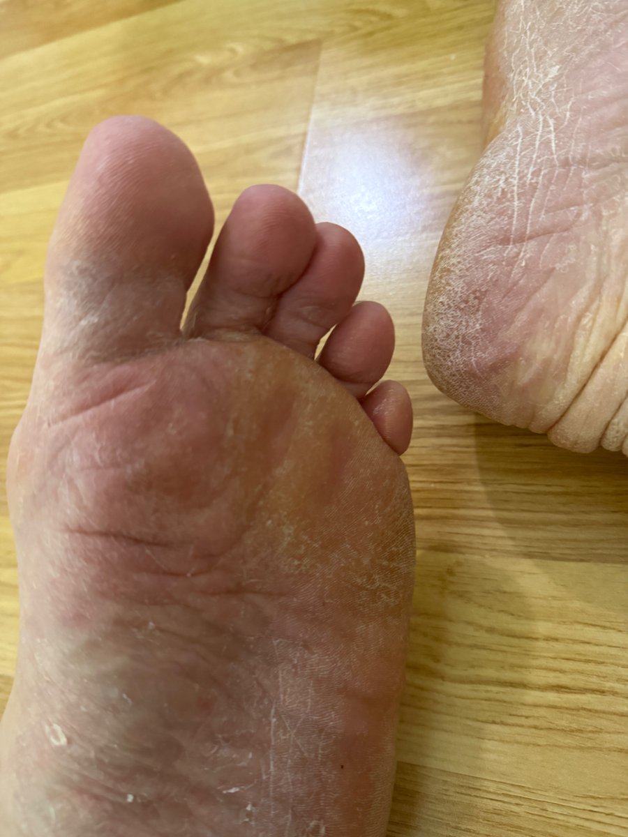 Real_NoFilter's tweet photo. Dry and rough…. Just for you https://t.co/jT3llzGus2