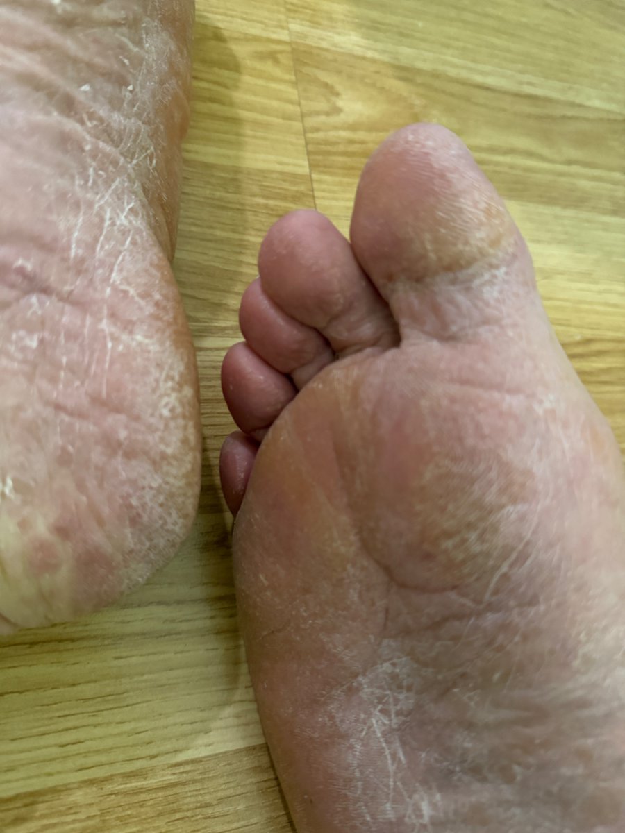 Real_NoFilter's tweet photo. Dry and rough…. Just for you https://t.co/jT3llzGus2