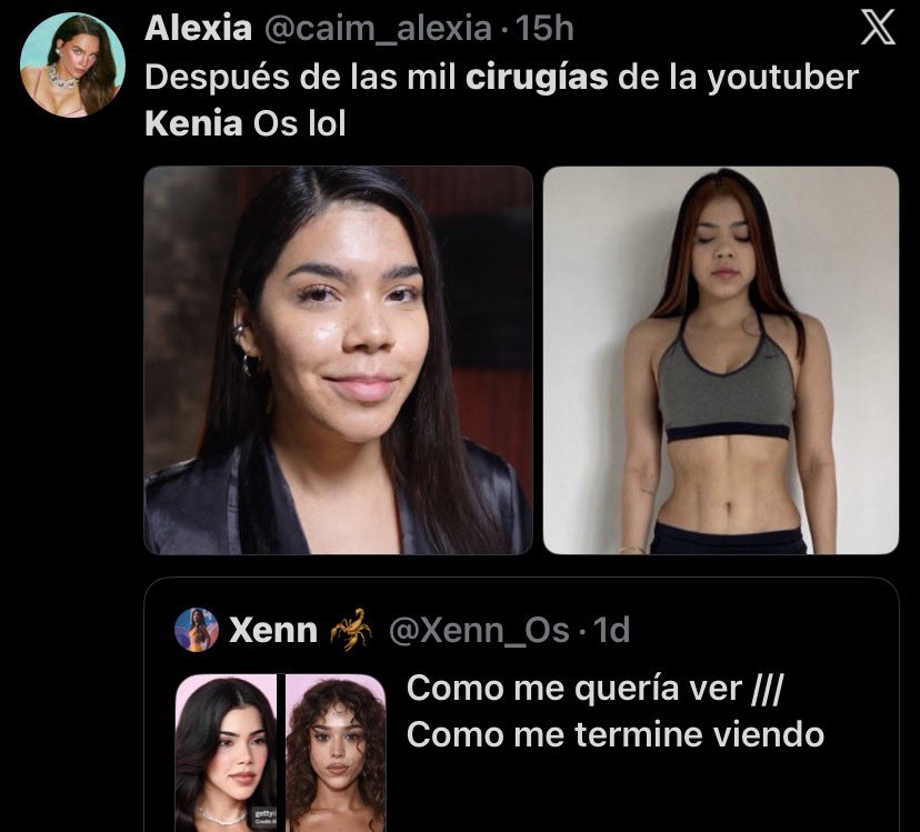 amiafallenangel's tweet photo. No soy realmente fan de ninguna de las dos ni nada por el estilo, pero podría alguien explicarme por qué les molesta tanto que las personas se hagan cirugías plásticas? Tipo, ¿por qué se agarran de eso para tirarle a alguien? https://t.co/lx6VFyjFhs