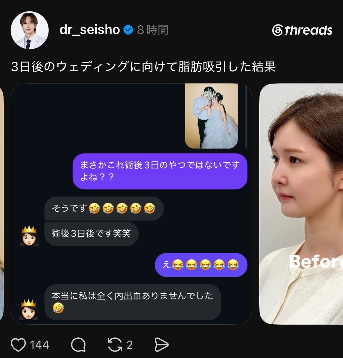 yupi0100's tweet photo. 結婚式3日前に脂肪吸引⁉️私1週間は腫れでパンパンだったけど、よくやったな.... https://t.co/jdo2wIHfSW