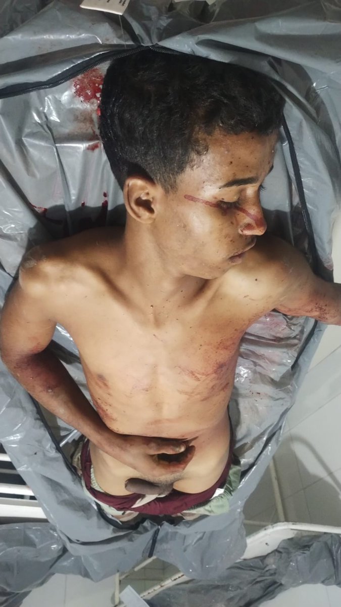 CAOSNORJ021's tweet photo. ATUALIZAÇÃO - MORTOS NA BEIRA RIO, EM JAPERI.

Foram atualizadas as informações sobre os mortos na guerra do tráfico na comunidade Beira Rio, em Japeri, na Baixada Fluminense.

Segundo informações, os homens que foram levados para a Policlínica de Japeri no Caveirão, durante a operação realizada ontem, domingo (19), pelo 24º BPM na comunidade, já chegaram ao local sem vida.

Ainda de acordo com informações preliminares, todos seriam ligados ao tráfico local e apontados como integrantes do TCP - Terceiro Comando Puro.

A operação contou com apoio de blindado na comunidade Beira Rio.