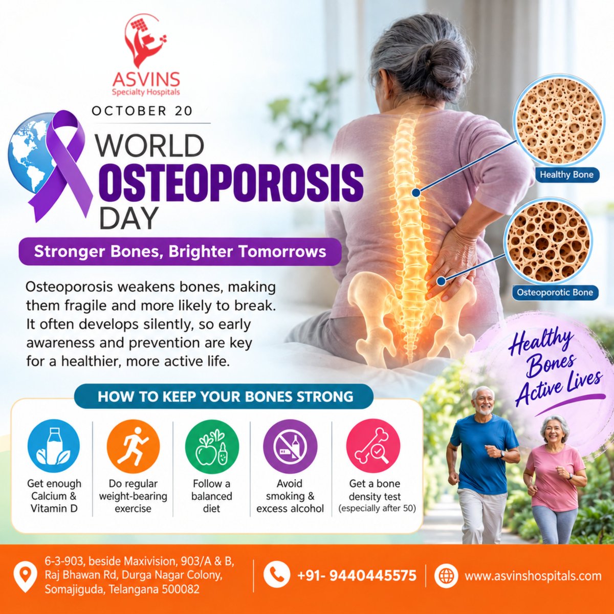 asvinshospitals's tweet photo. 🦴💜 World Osteoporosis Day – October 20 💜🦴

📞 +91 9440445575  
🌐 https://t.co/ULLJeh1UL8

#WorldOsteoporosisDay #OsteoporosisAwareness #StrongerBones #BoneHealth #HealthyBones #OsteoporosisPrevention #Calcium #VitaminD #HealthyAging #BoneDensityTest #HealthAwareness https://t.co/gbxcOb3FJV