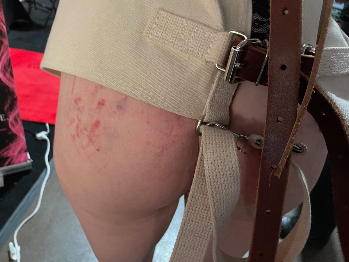 L0calD3generate's tweet photo. The results of my impromptu (see videos below) impact play session with @kinkylittlekora  at Taboo Show Toronto, immediately after and a day later. Images posted with permission. 

#spanked #ImpactPlay #bdsmِ  #spanking https://t.co/3peGK3tnGH