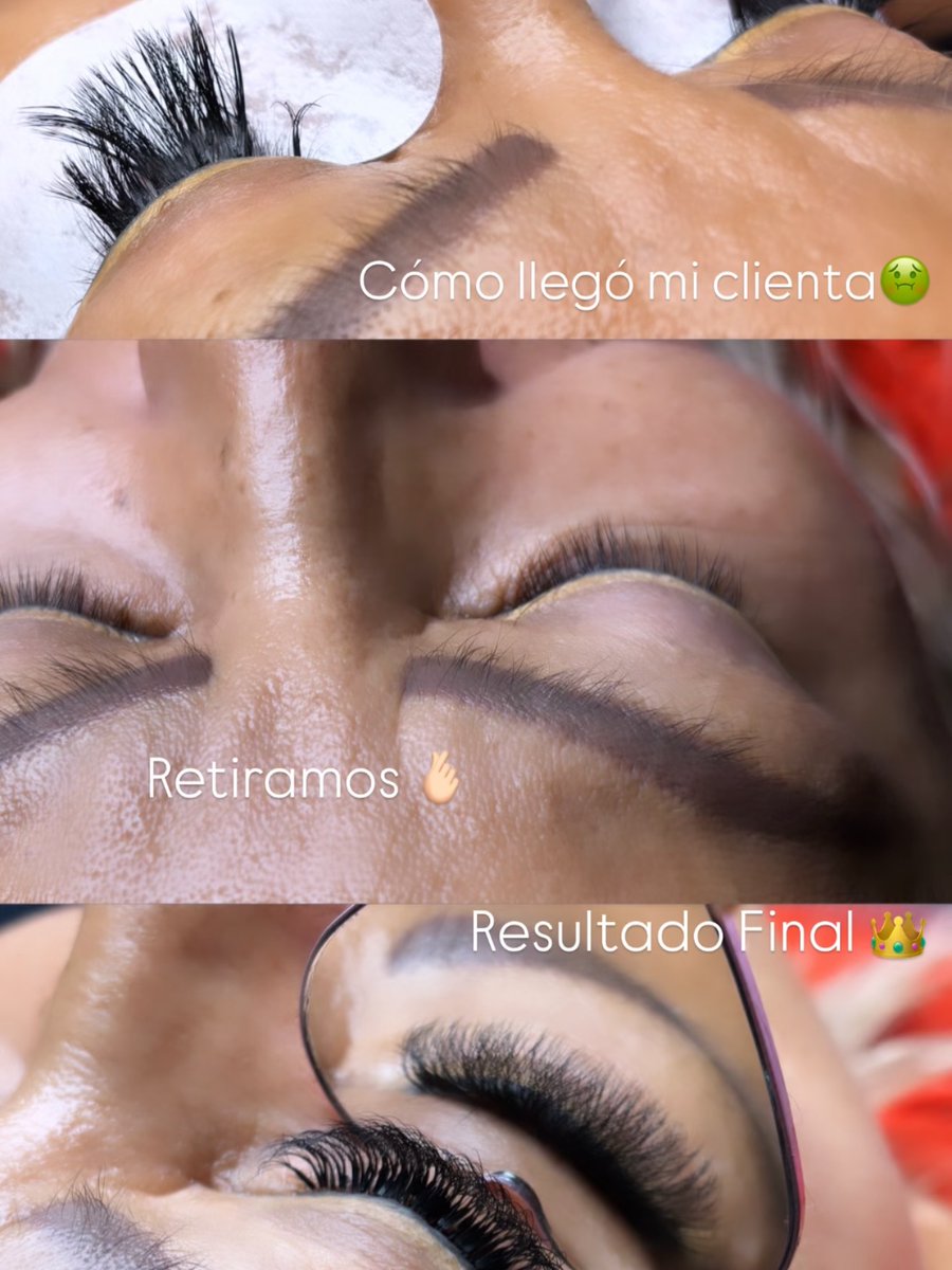 foucherjacmxle's tweet photo. How my client arrived; she had her previous set removed and a new set applied. https://t.co/MM86Q6aqYP