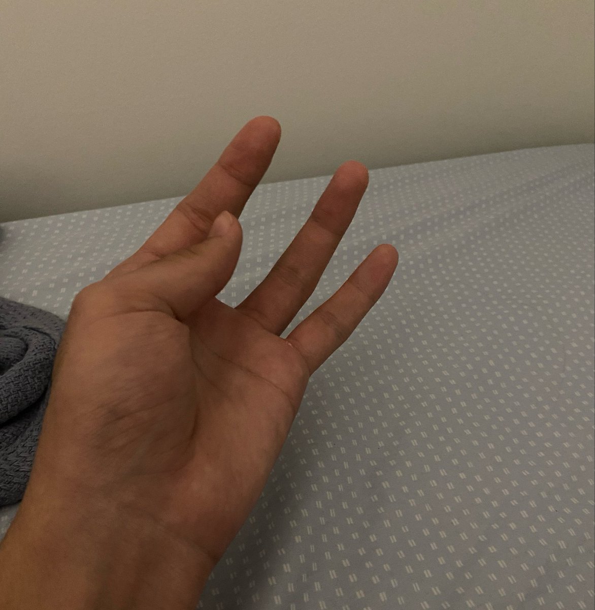 royal_coda's tweet photo. I lost my finger in a horrible accident #truth #tellingthetruth #notlying #truestory https://t.co/sa5zodKg1t