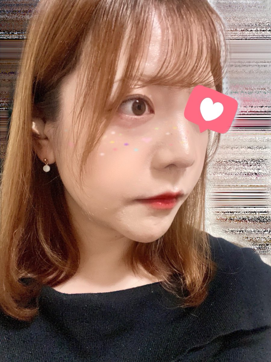 akabekoland's tweet photo. ←無課金　→微課金（上下顎セットバックetc) https://t.co/ETRECUvDw7