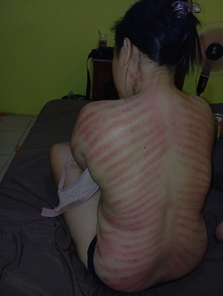YohanesS27722's tweet photo. Kerokane Roto sampe bokong abang geseng https://t.co/BhncjGyQNf