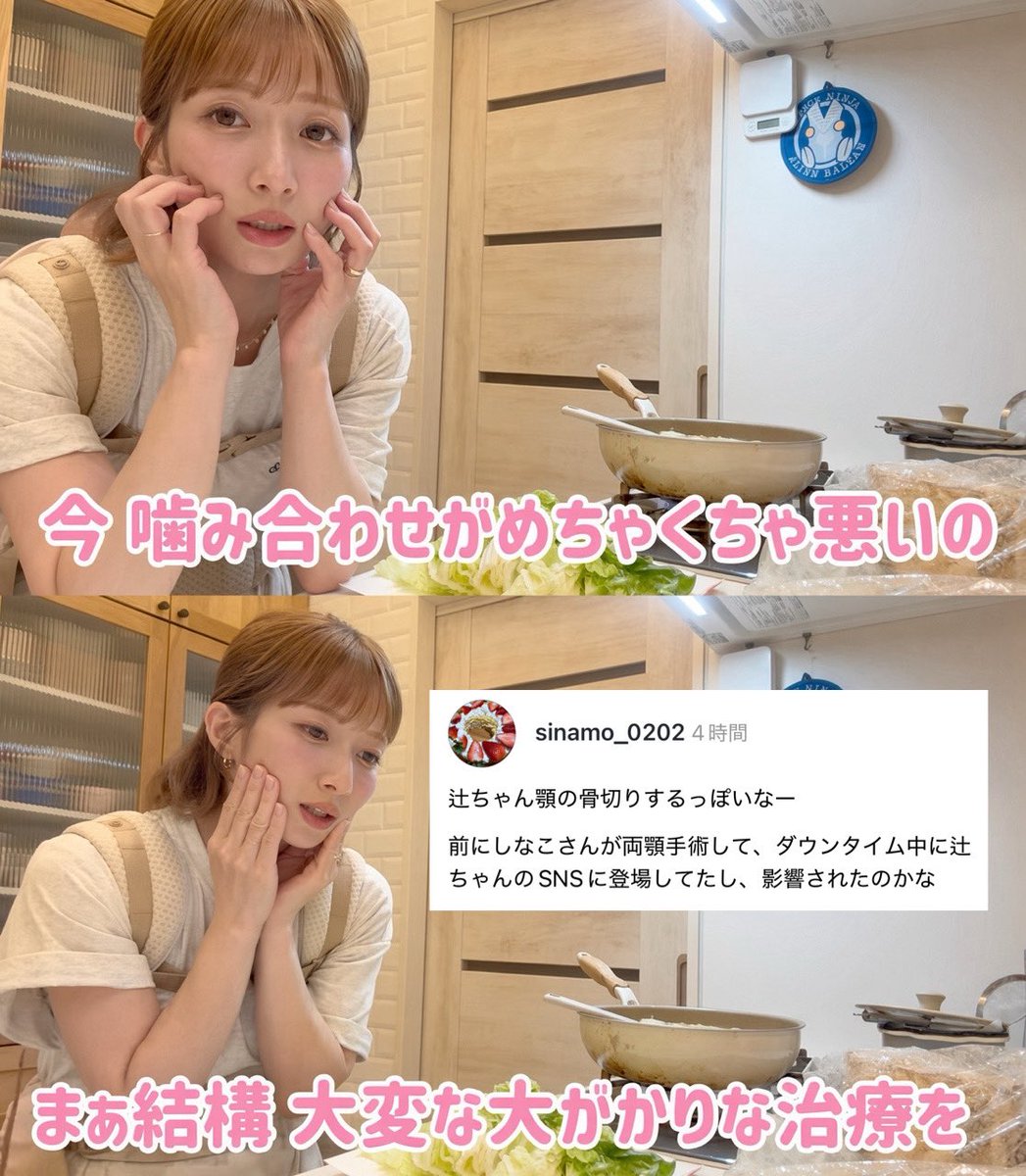 3b2zg's tweet photo. 【悲報】辻希美さん、両顎手術を行う模様

40歳での骨切りは相当な輪郭弛みリスクがあることは確かで、フェフ姉さんの多田さんの様にフェイスラインの土砂崩れが起こる可能性も十分あり得る。

ディープバイトとは言え、今の顔を変えてまで骨切りするリスクリターンはどうなのかという意見で溢れかえる https://t.co/d74D4ZHC0k
