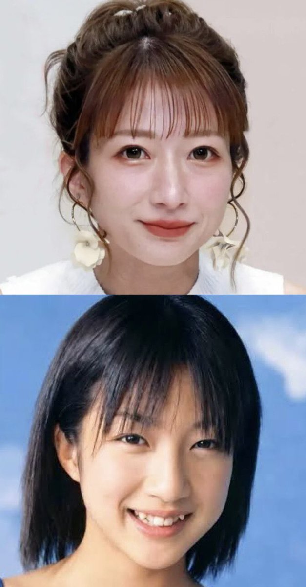 3b2zg's tweet photo. 【悲報】辻希美さん、両顎手術を行う模様

40歳での骨切りは相当な輪郭弛みリスクがあることは確かで、フェフ姉さんの多田さんの様にフェイスラインの土砂崩れが起こる可能性も十分あり得る。

ディープバイトとは言え、今の顔を変えてまで骨切りするリスクリターンはどうなのかという意見で溢れかえる https://t.co/d74D4ZHC0k