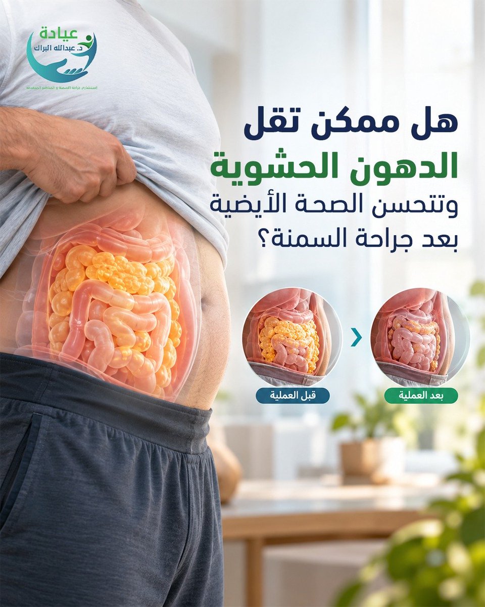 albarrak_clinic's tweet photo. نعم، جراحة السمنة تساعد على تقليل الدهون الحشوية المحيطة بالأعضاء الداخلية، وتحسين حساسية الجسم للإنسولين ومستويات السكر والدهون في الدم.
#جراحة_السمنة 
#صحة_أفضل 
#سمنة 
#اكسبلور https://t.co/fyTqV0TADl