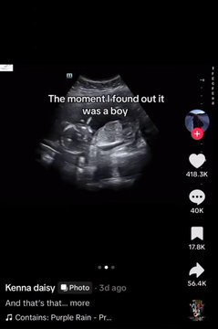 grisasexual's tweet photo. Una feminista anuncia que va a abortar a su bebe cuando descubre que sera varón, y lo mata por ser varón.
Recibe apoyo masivo de mujeres en redes.
El feminismo apoya el genocidio por cuestión de genero sin rubor. https://t.co/7iVbCL6Xzj