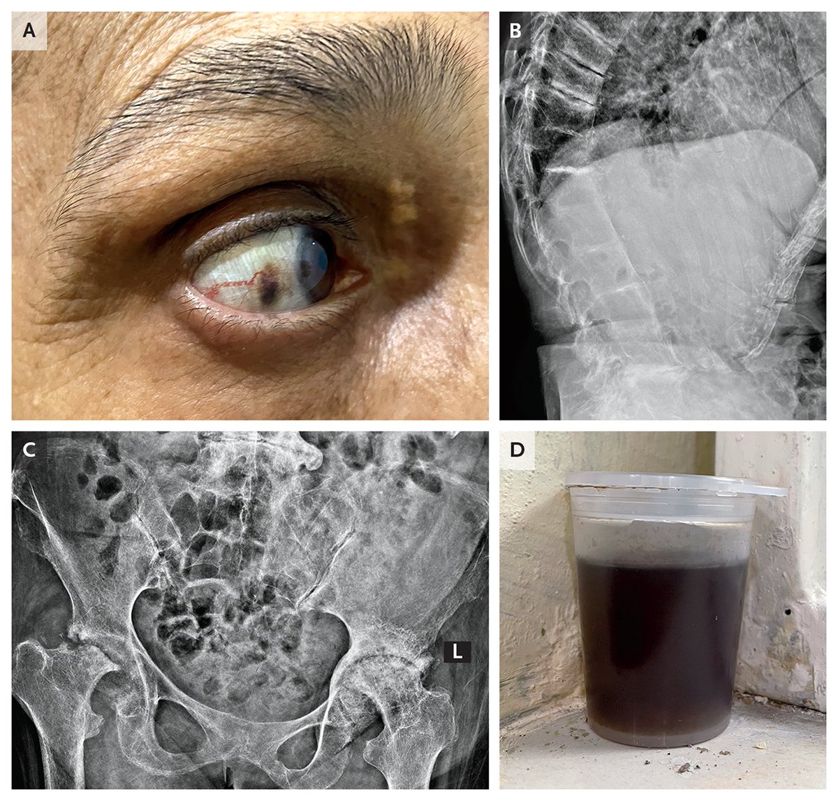 NEJM tweet picture