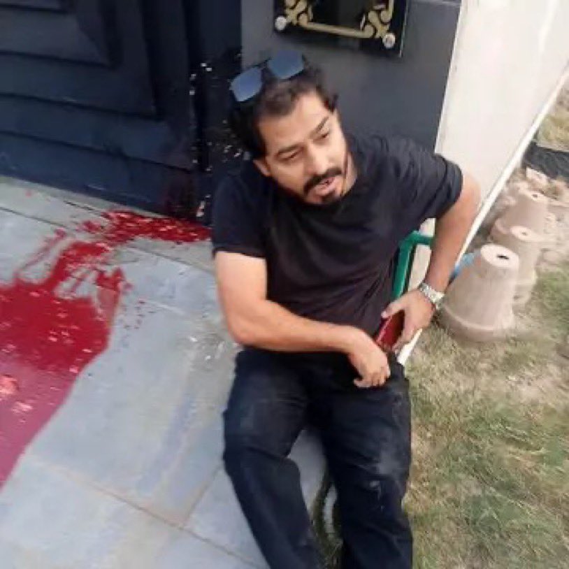 noshigilani's tweet photo. 🔹 بچے جب کسی شخص یا مقام سے یوں بھاگتے ہیں تو یہ امکان بھی ہوتا ہے کہ انہیں جنسی ہراسگی کا سامنا ہو ۔۔ صرف کام چھوڑنے پر کوئ اتنامش��عل کیسے ہو سکتا تھا ۔

🔹 لیکن یہ یتیم لڑکا کس سے شکایت کرتا ۔۔ اس اشتعال پسند معاشرے میں سُنتا بھی کون ہے ۔💔💔 https://t.co/knsNnQ25V1