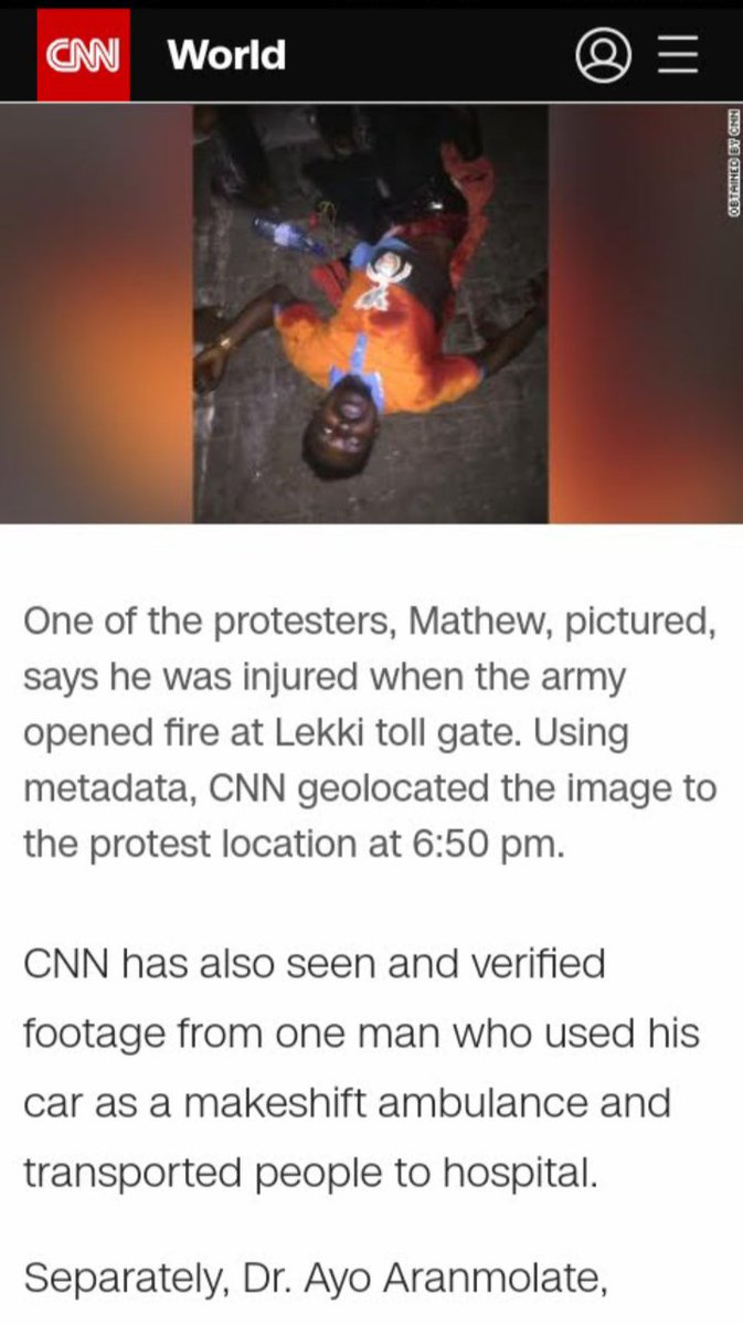 ComedyStone's tweet photo. May all Nigeria citizens that lost their life at Lekkitollgate during the protest #endsars protest because I was shot at Lekkitollgate on 20-10-2020 #protest Kolu Korope Bae u Buju #EndSARS Creators #LEKKIMASSARCE @officialABAT @STinubu @boytv_cartoon @OfficialAPCNg @NigeriaGov https://t.co/tGcemzailu