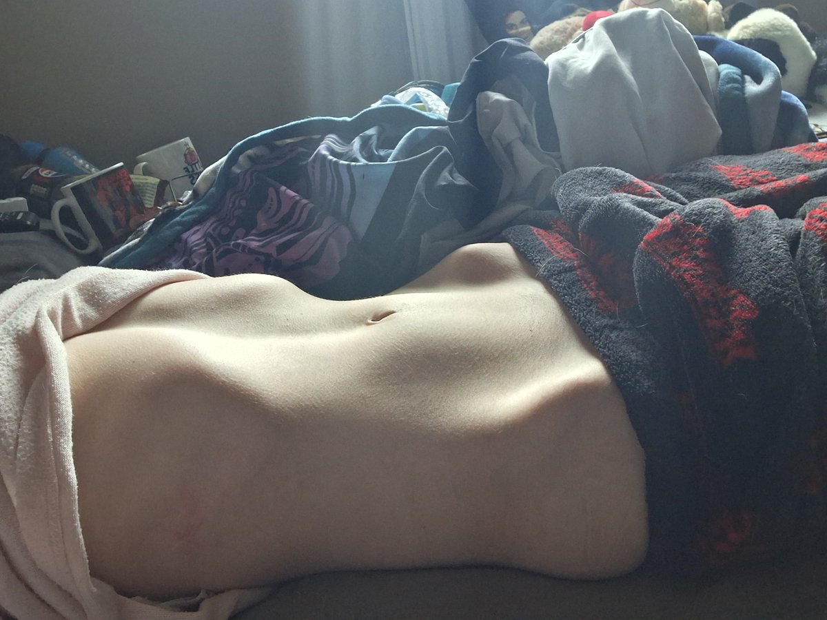 itsharlyn05's tweet photo. Ignore the bloating, I can't use the toilet atm bc someone's in there 😭💔 BUT LOOK AT THOSE HIP BONES HELLO?? #edrtwt #bodycheck #ricecaketwt https://t.co/YlQKJdj7vh
