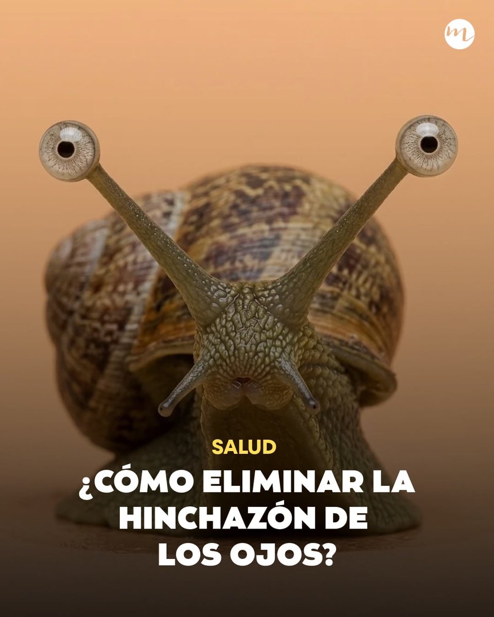 revistamoi's tweet photo. ¿Tienes bolsa tras bolsa en los ojos? Te damos el mejor hack para olvidarte de la hinchazón. https://t.co/nEjlxt4fJE https://t.co/QEprqqI8f6