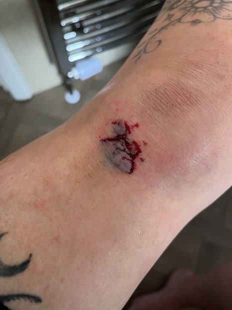 MistressVoh5's tweet photo. I fell on the ground 😮‍💨😮‍💨 https://t.co/ihqW89nk39