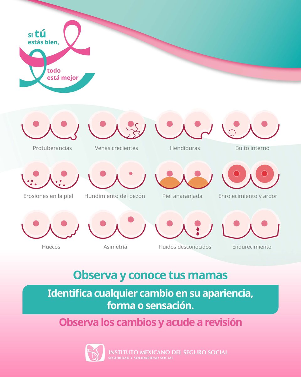 IMSSGro's tweet photo. La detección oportuna hace la diferencia 🩷
Aprende a conocer tus mamas e identifica cualquier cambio en su apariencia, forma o sensación:
▪️ Protuberancias o bultos internos
▪️ Hundimientos o asimetría
▪️ Cambios en la piel o fluidos
Ante cualquier señal, acude a revisión médica https://t.co/VQGdYMXyFG