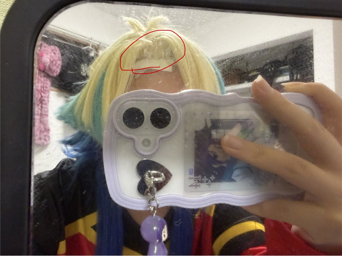 xlj260's tweet photo. ここの生え際めっちゃチクチクするんですけどｻﾞｰのコスプレしてる人どうしてますか!? https://t.co/yHslaiy9YZ