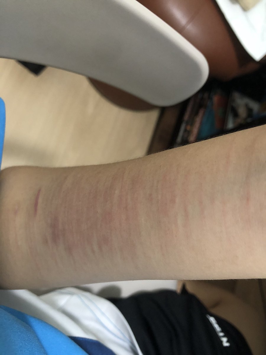 ehgitama's tweet photo. Not actual cuts sadly💔 https://t.co/qiD54vggXS
