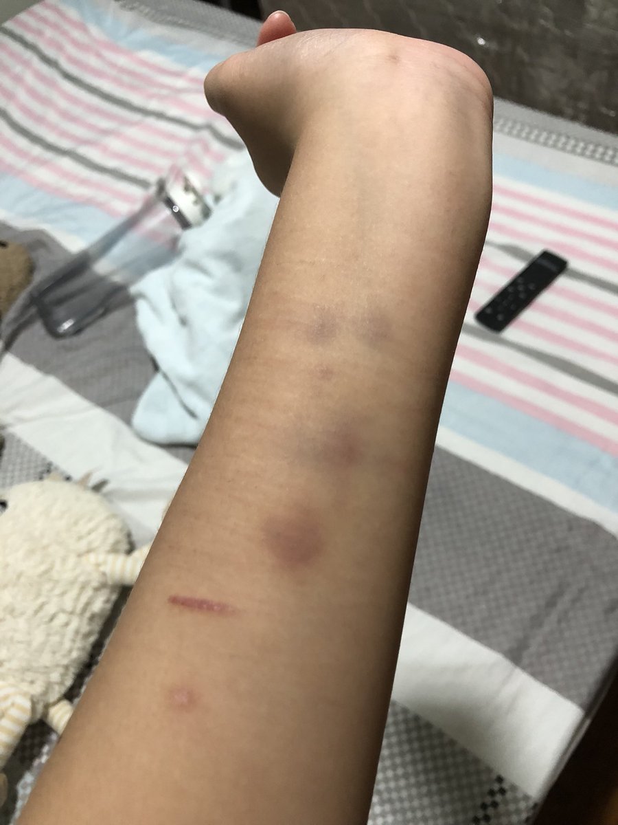 ehgitama's tweet photo. Not actual cuts sadly💔 https://t.co/qiD54vggXS