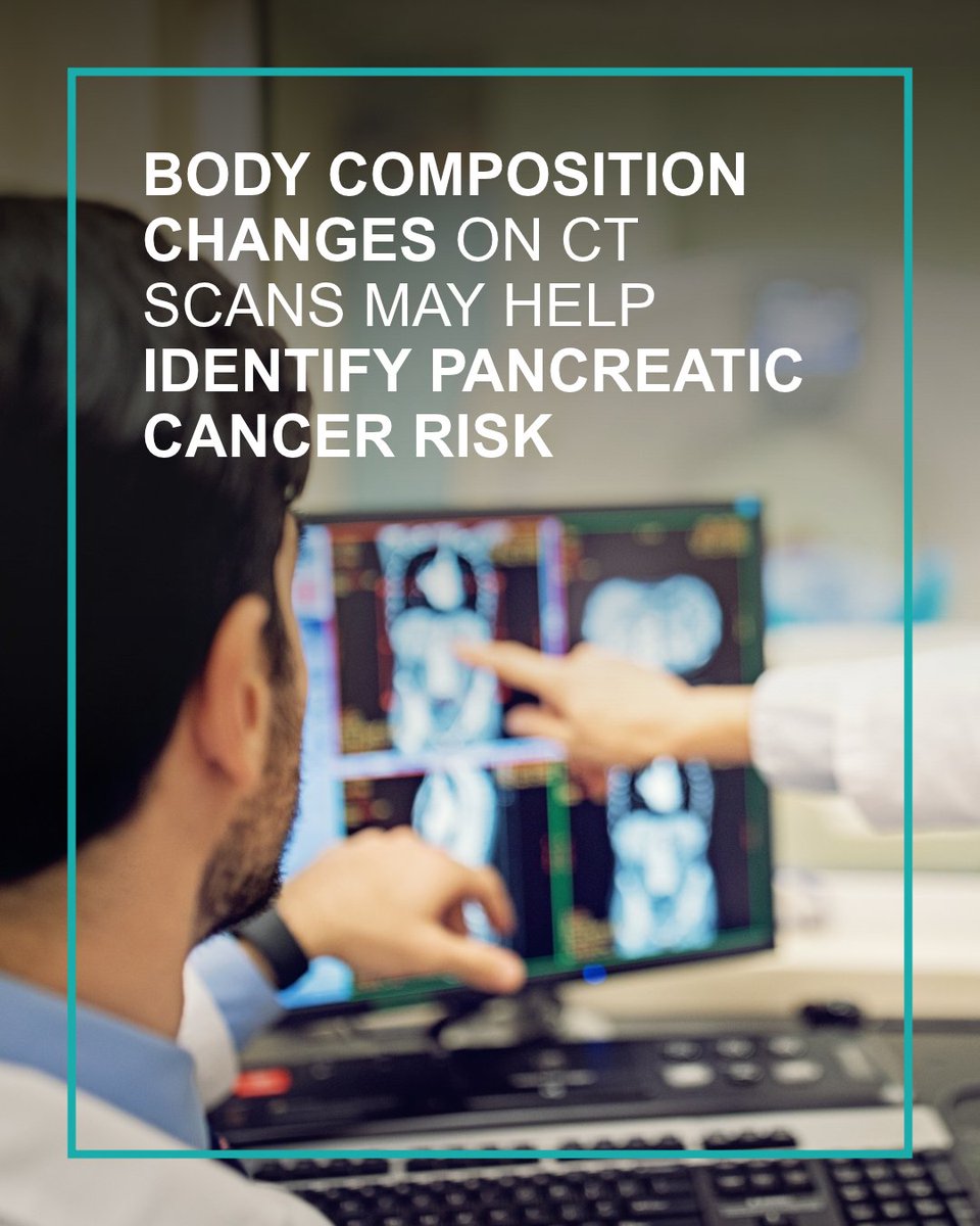 MayoClinic's tweet photo. Pancreatic cancer remains one of the deadliest cancers, largely because most patients are diagnosed after the disease has already spread. According to a Mayo Clinic study, people who develop pancreatic cancer experience measurable changes in body composition years before diagnosis that differ from those seen in similar individuals without cancer.

Learn more about the study: https://t.co/jsE7mnakj8