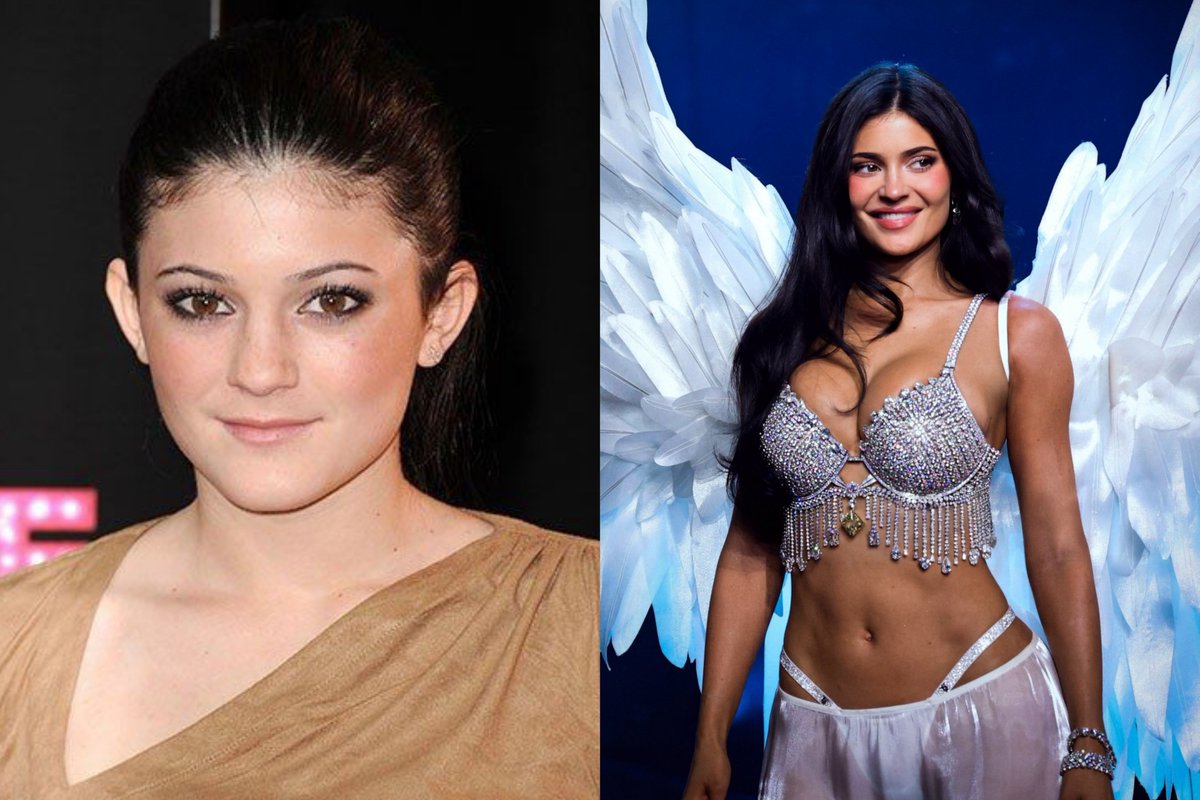 Men_Queue's tweet photo. What did she eat? 
11 years of crazy glow up.😨

Kylie at 18                                Kylie at 29 https://t.co/RfK59wkewC