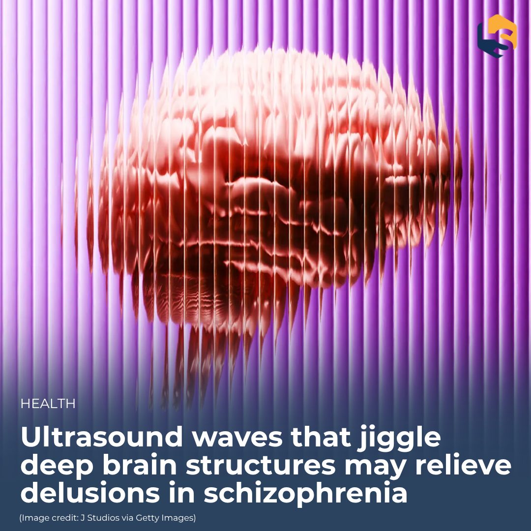 LiveScience's tweet photo. In a new pilot study, 10 minutes of transcranial ultrasound stimulation reduced patients' delusion severity, scientists report.
🔗 Read more here: https://t.co/U55cKcybnZ https://t.co/GKu0fhwtwc
