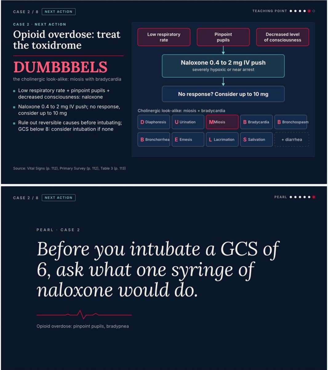 EMJointActivity's tweet photo. “Find the killer first. The CT can wait one minute.” Low RR + pinpoint pupils + low GCS think naloxone. Febrile and altered with no source think LP after imaging. #EmergencyMedicine#SBEM #FOAMed #OnePulse https://t.co/jO5IGlbY2m
