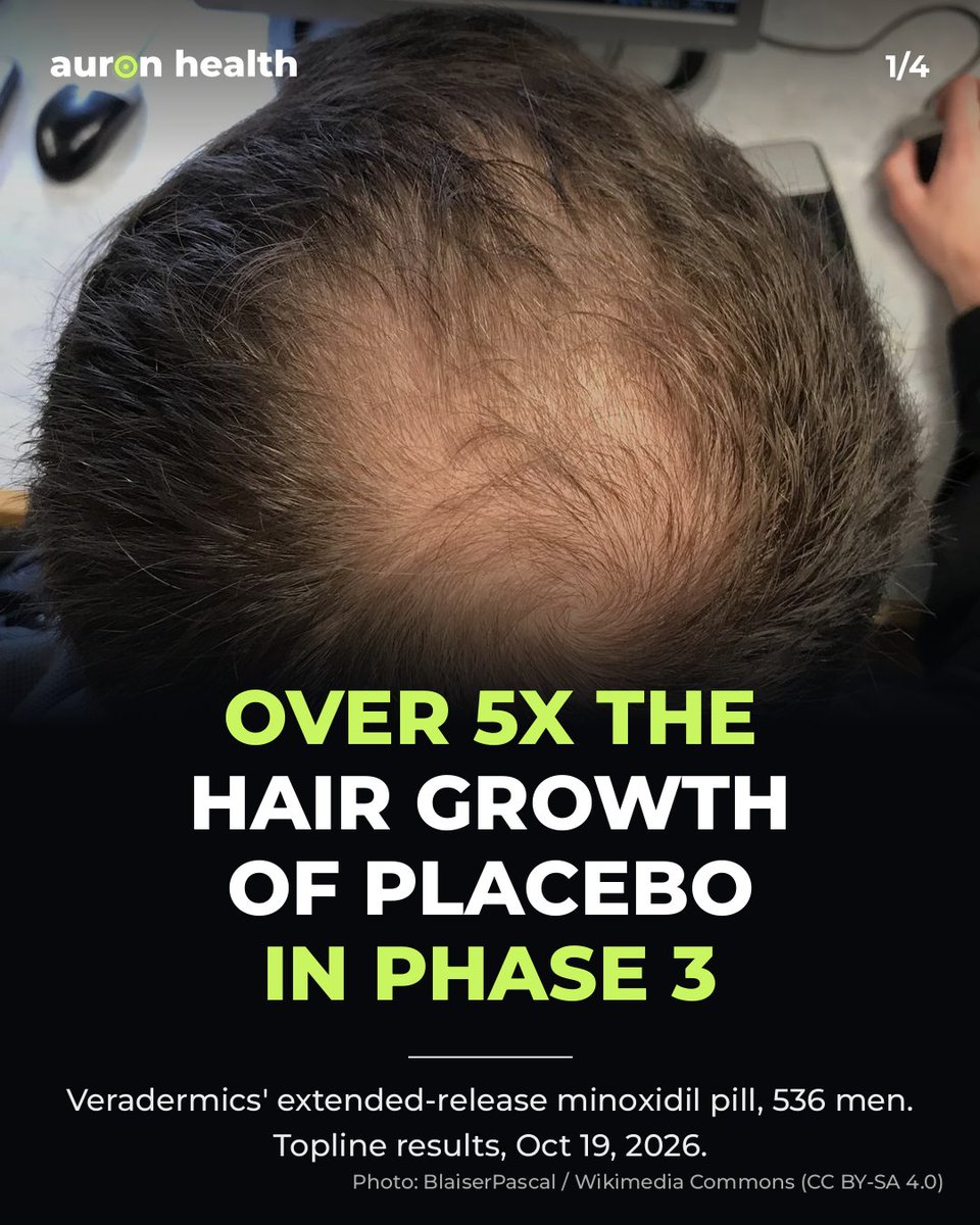 Auronhealth's tweet photo. A pill for male pattern hair loss added 36.4 hairs per cm² in 6 months vs 6.6 on placebo, in a 536-man Phase 3 trial.

It's Veradermics' extended-release oral minoxidil. Company topline data, not peer reviewed or FDA approved yet.
https://t.co/i1U3yTgDWi
#longevity #hairloss https://t.co/1jdLE3y2UR