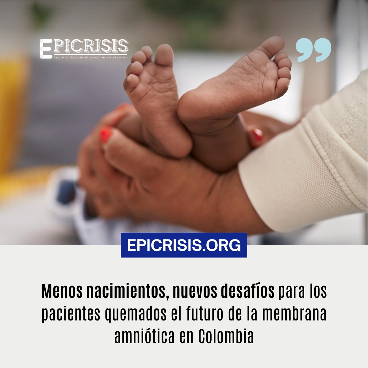 ColegioMedicoCo's tweet photo. La membrana amniótica es una fina capa de tejido que forma parte de las membranas que rodean al bebé durante el embarazo. Después del parto, y siempre que exista consentimiento para la donación y se cumplan los requisitos médicos y de seguridad, este tejido puede recuperarse, procesarse y utilizarse con fines terapéuticos.

Lea este artículo completo en Epicrisis ▶ https://t.co/n80VC6uy41

#donación #natalidad #quemados #columna #cmc
