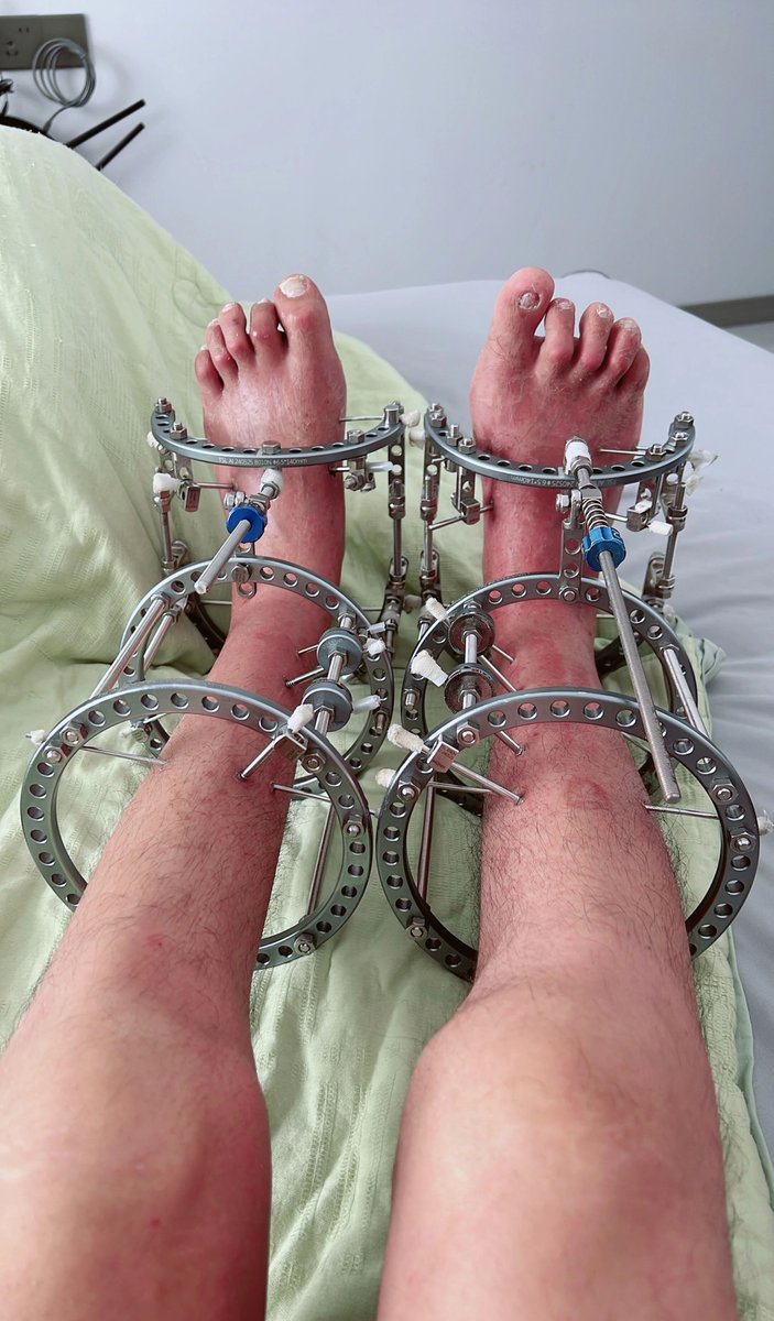 freetheboyyy's tweet photo. Every step toward recovery takes strength, patience, and courage. the journey may be painful, but giving up is never an option. 💪 https://t.co/TeSqp4LQLI