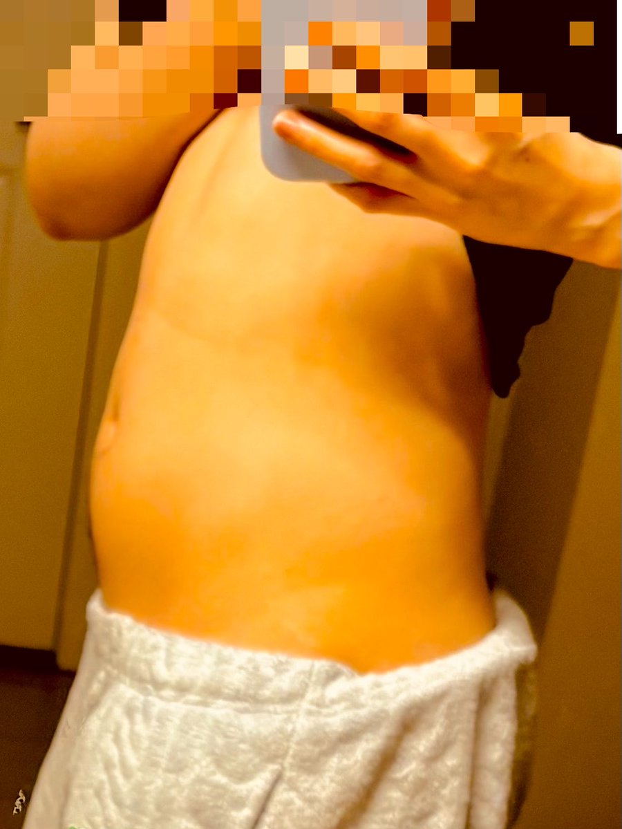 moonlitseaya's tweet photo. From the front:
wow I look good not bad cool

From the side:
WHAT THE *ACTUALL*FFF*****CK 🤬😭😭 https://t.co/FwQzj6a17e