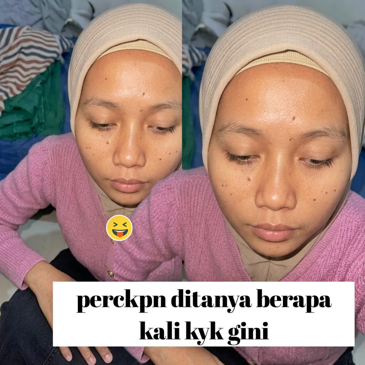 Kjzzfhjknn0s's tweet photo. BRAPA KALI? 

https://t.co/FJjbiRWEAm https://t.co/8R9XLXB0j5