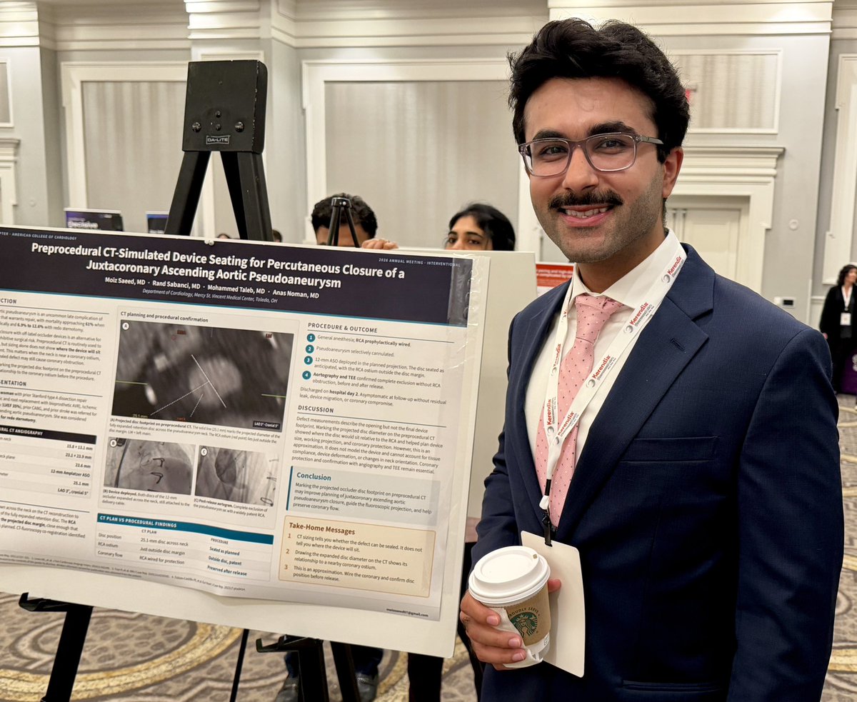 saeedmoi's tweet photo. Presented our case at the Ohio ACC 2026 Annual Meeting: using preprocedural CT to simulate occluder disc seating for percutaneous closure of a juxtacoronary ascending aortic pseudoaneurysm.
CT sizing tells you if the defect can be sealed, not where the device will sit.
@OhioACC https://t.co/30tlrYw9Ql