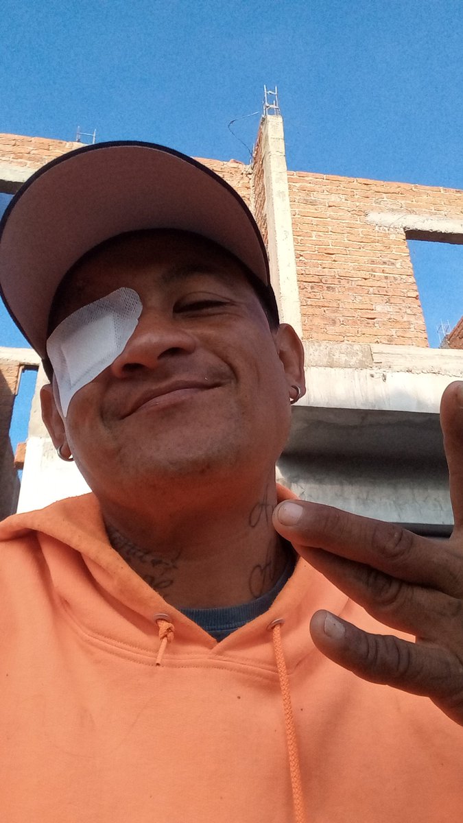 pelonvl3x's tweet photo. @Lumamrms @BillBailey I have a medical problem in my face and I need som medical atencion and is  very expensive and God will bless you it you can help me https://t.co/ByZ66BoZ8T