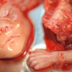 Photo by Pro-Life Greenville, SC (@ChooseLifeGVL)