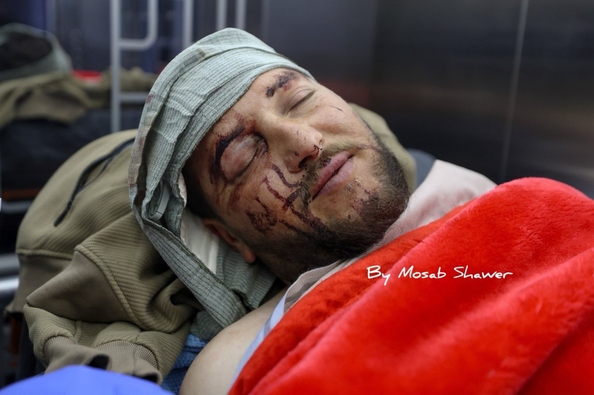 EyeonPalestine's tweet photo. Saeed Rshaideh was admitted to the ICU at Al-Ahli Hospital in Hebron after being brutally attacked by settlers with sharp objects while grazing sheep in Masafer Yatta, south of Hebron. https://t.co/P1XiRSzh0b