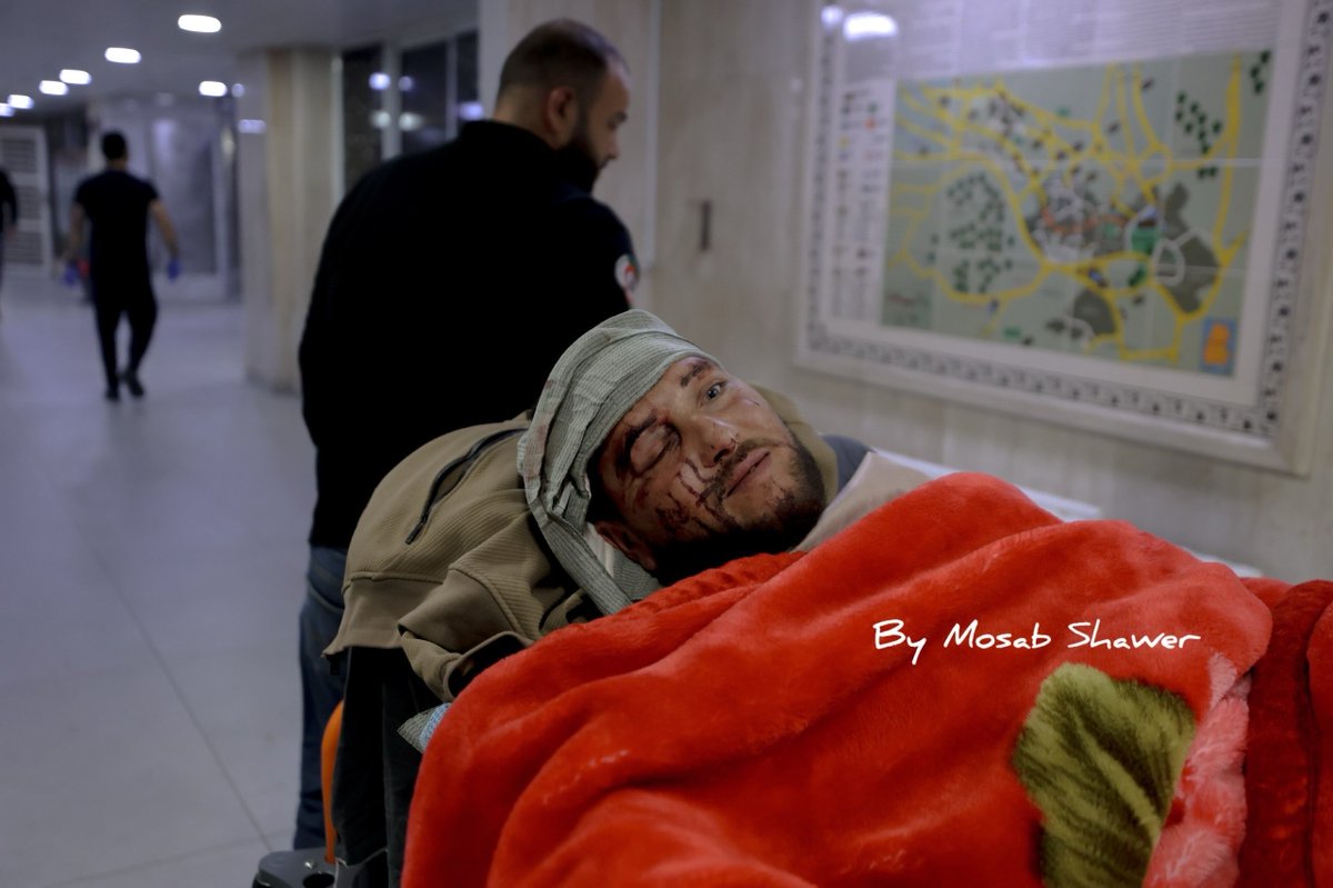 EyeonPalestine's tweet photo. Saeed Rshaideh was admitted to the ICU at Al-Ahli Hospital in Hebron after being brutally attacked by settlers with sharp objects while grazing sheep in Masafer Yatta, south of Hebron. https://t.co/P1XiRSzh0b