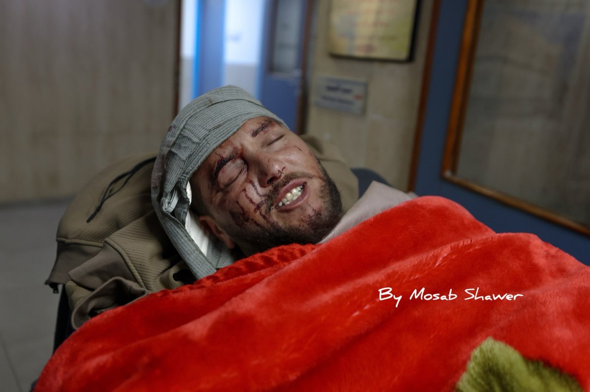 EyeonPalestine's tweet photo. Saeed Rshaideh was admitted to the ICU at Al-Ahli Hospital in Hebron after being brutally attacked by settlers with sharp objects while grazing sheep in Masafer Yatta, south of Hebron. https://t.co/P1XiRSzh0b